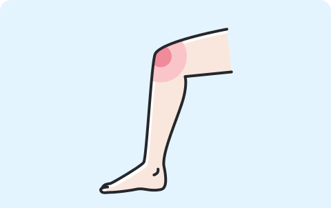 関節の痛み